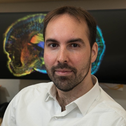 Thumbnail for Feb 18 | Insights of molecular mechanisms of cortical development and Down syndrome through single-cell multi-omics